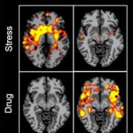 Study Suggests Gender Differences in Root Causes of Addiction